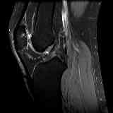 SAG DP FAT